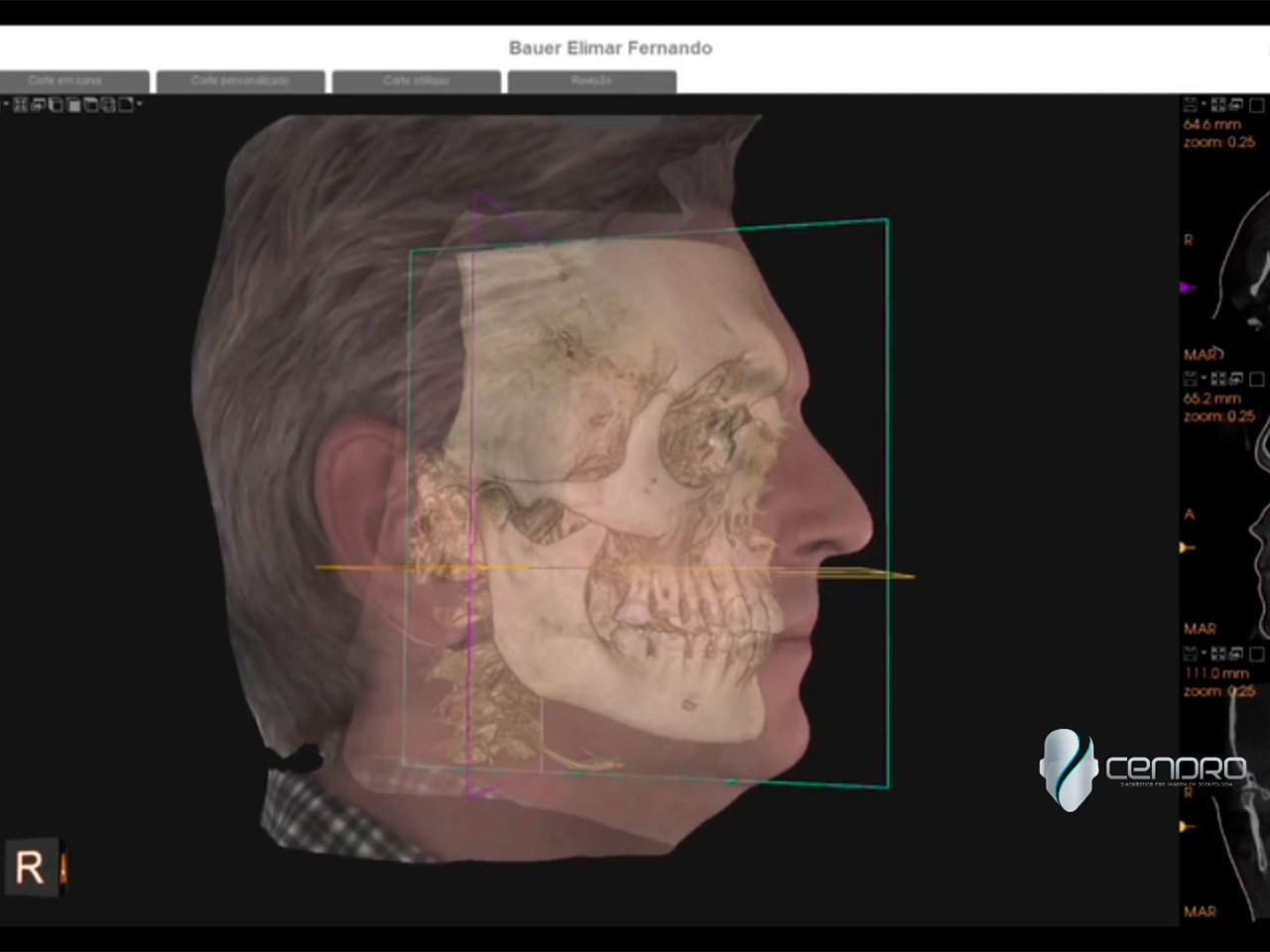 CENDRO AGORA COM ESCANEAMENTO FACIAL