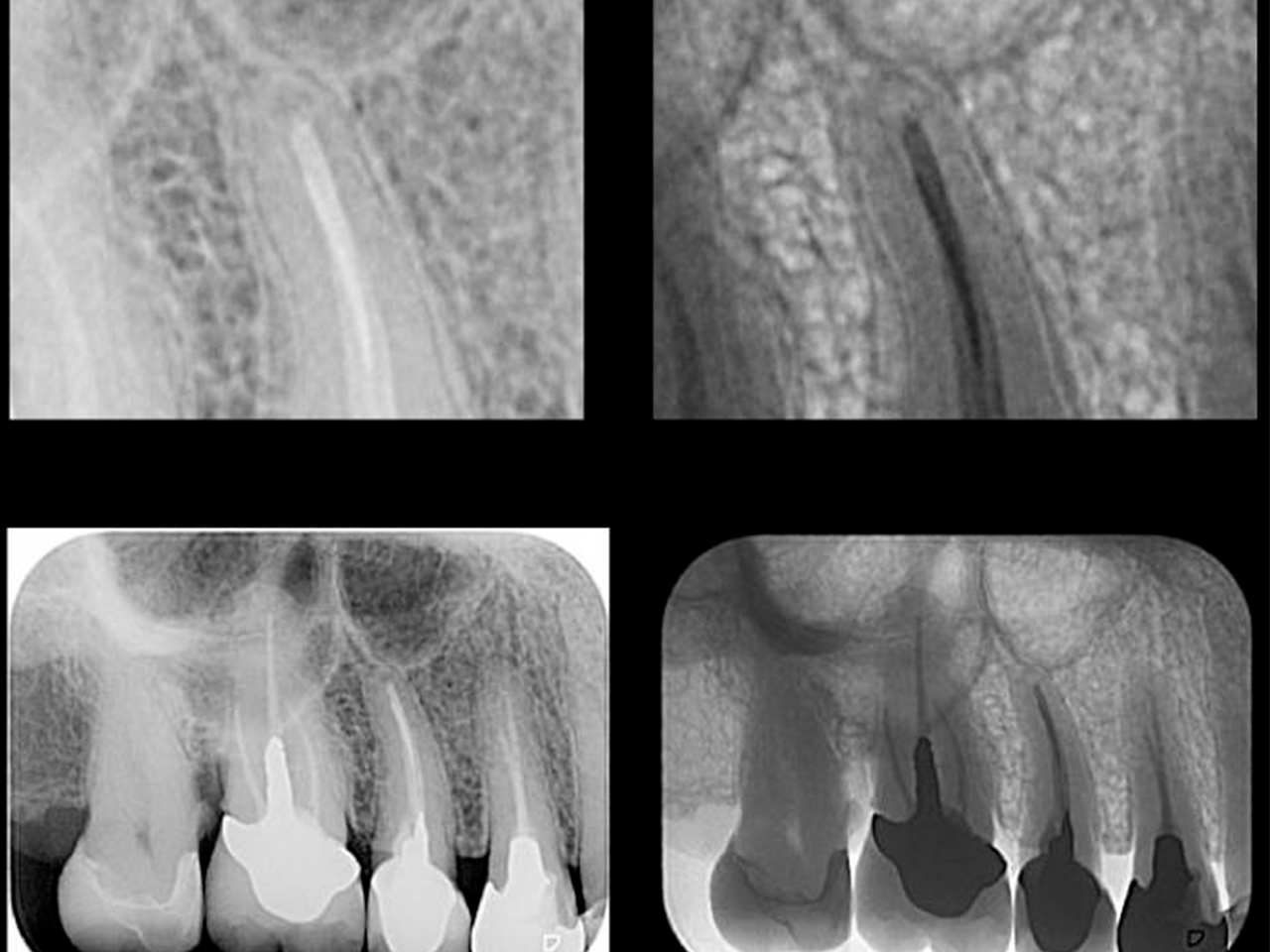 O QUE É PRECISO PARA A AQUISIÇÃO DE UMA IMAGEM DE EXCELÊNCIA NA RADIOLOGIA?