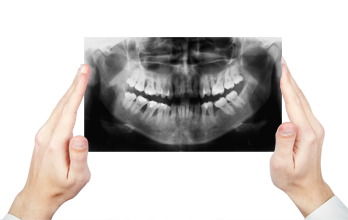 Cendro Radiologia Odontológica